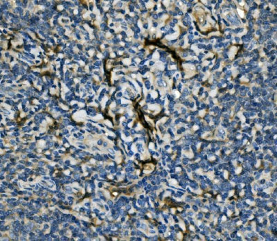 Anti-EIF4A1 Antibody Picoband® Boster Bio