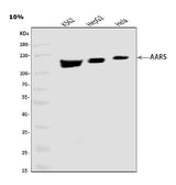 Anti-AlaRS/AARS1 Antibody Picoband® Boster Bio