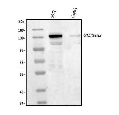 Anti-SLC34A2 Antibody Picoband® Boster Bio