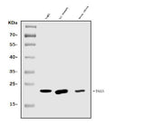 Anti-TAGLN/Transgelin Antibody Picoband® Boster Bio