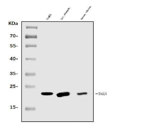 Anti-TAGLN/Transgelin Antibody Picoband® Boster Bio