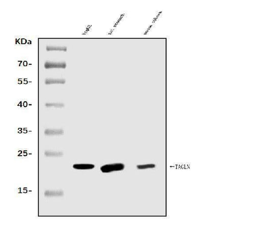 Anti-TAGLN/Transgelin Antibody Picoband® Boster Bio