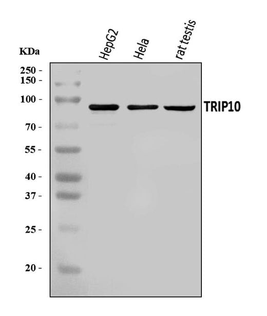 Anti-Cip4/TRIP10 Antibody Picoband® Boster Bio