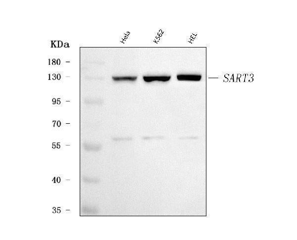 Anti-SART3 Antibody Picoband® Boster Bio