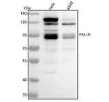 Anti-Palladin/PALLD Antibody Picoband® Boster Bio