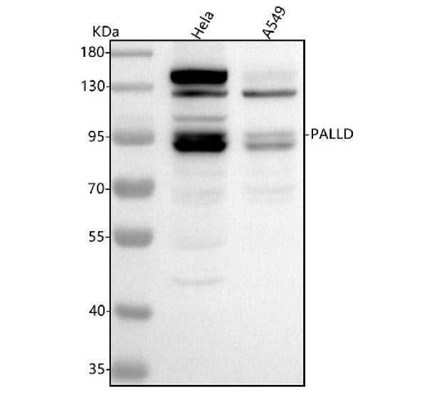 Anti-Palladin/PALLD Antibody Picoband® Boster Bio