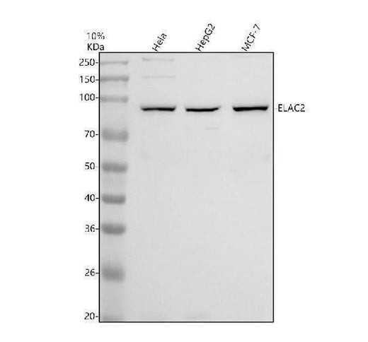 Anti-DNAAF2 Antibody Picoband® Boster Bio