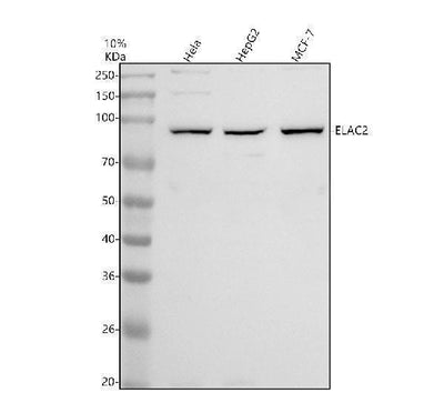 Anti-DNAAF2 Antibody Picoband® Boster Bio