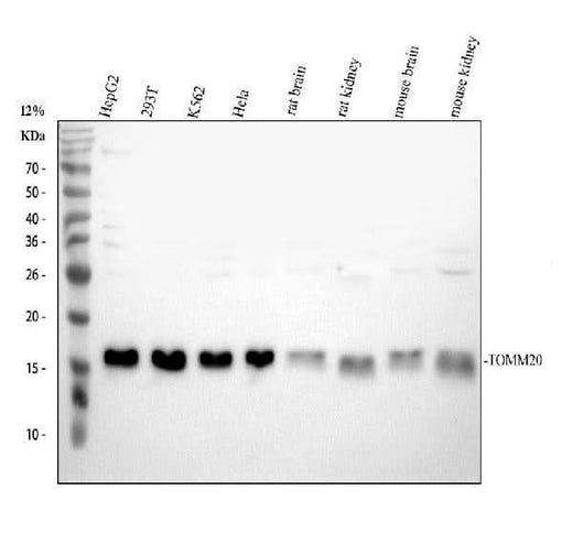 Anti-TOMM20 Antibody Picoband® Boster Bio