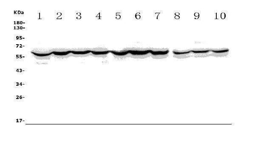 Anti-ACCN1/ASIC2 Antibody Picoband® Boster Bio