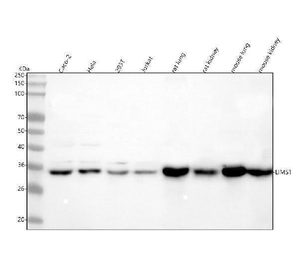 Anti-LIMS1 Antibody Picoband® Boster Bio