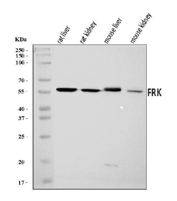 Anti-FRK Antibody Picoband® Boster Bio