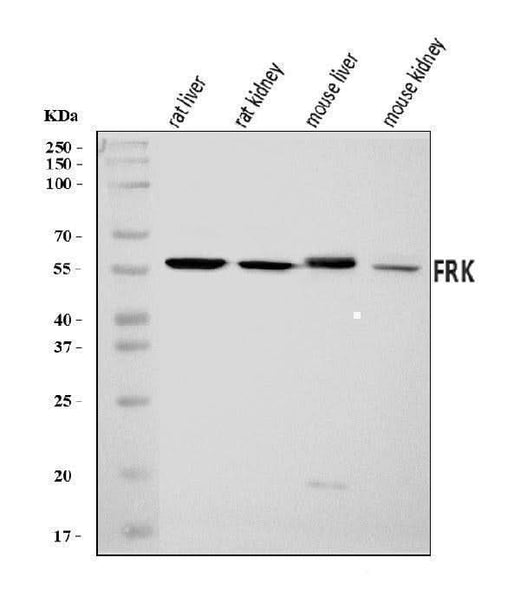 Anti-FRK Antibody Picoband® Boster Bio