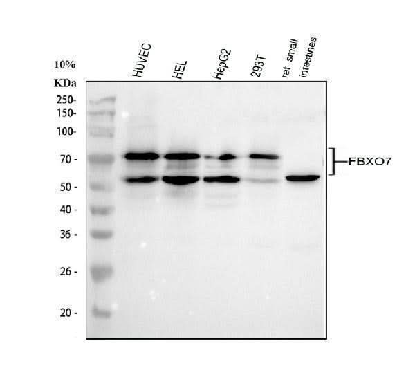 Anti-FBXO7 Antibody Picoband® Boster Bio