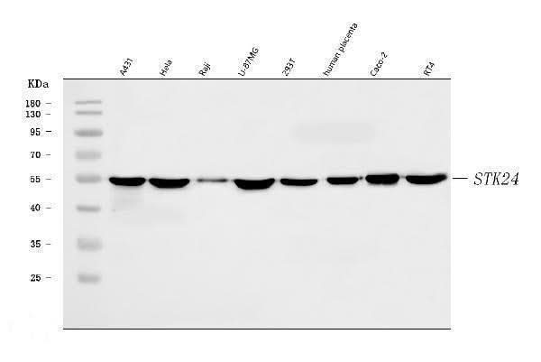 Anti-MST3/STK24 Antibody Picoband® Boster Bio