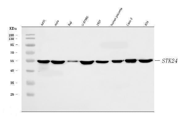 Anti-MST3/STK24 Antibody Picoband® Boster Bio