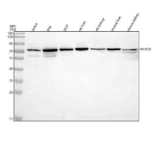 Anti-LGP2/DHX58 Antibody Picoband® Boster Bio