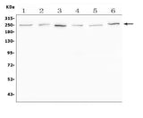 Anti-SCN11A Antibody Picoband® Boster Bio