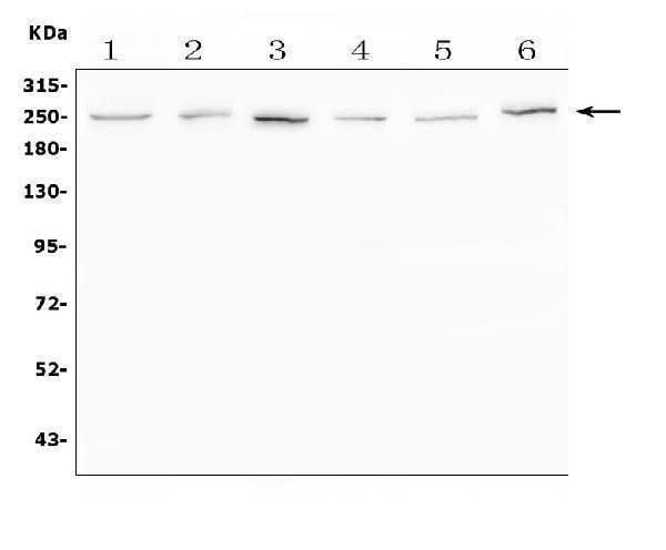 Anti-SCN11A Antibody Picoband® Boster Bio