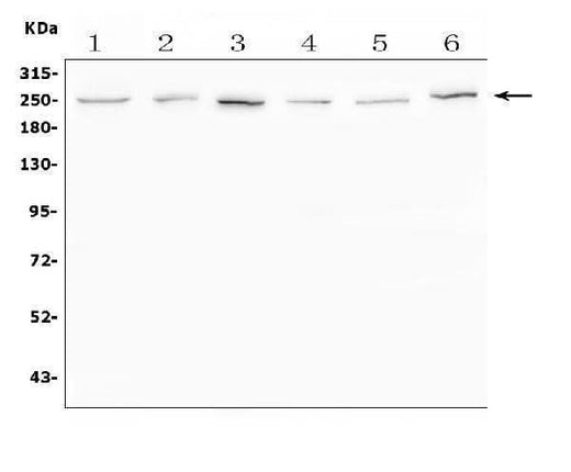 Anti-SCN11A Antibody Picoband® Boster Bio