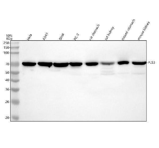 Anti-PLS3 Antibody Picoband® Boster Bio