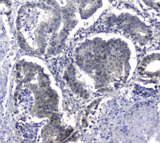 Anti-Hsp105/HSPH1 Antibody Picoband® Boster Bio