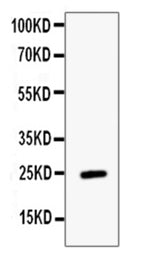 Anti-ESM1 Antibody Picoband® Boster Bio