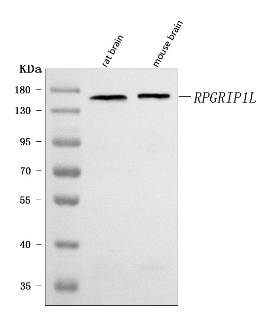Anti-RPGRIP1L Antibody Picoband® Boster Bio