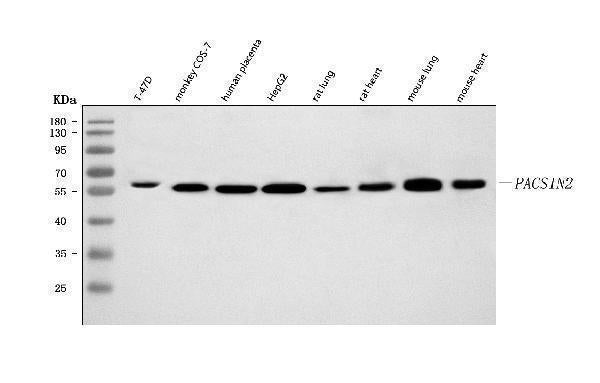 Anti-PACSIN2 Antibody Picoband® Boster Bio