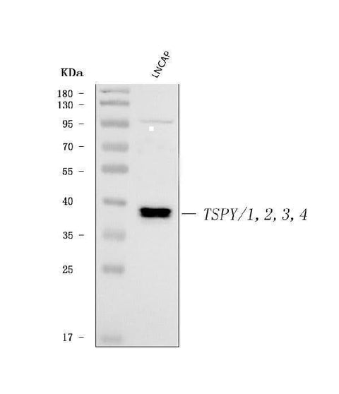 Anti-TSPY1/2/3/4 Antibody Picoband® Boster Bio
