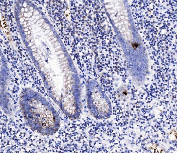 Anti-Peptide YY/PYY Antibody Boster Bio