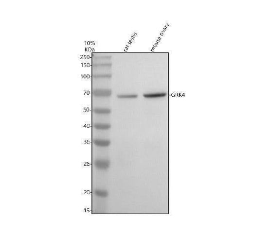 Anti-GRK4 Antibody Picoband® Boster Bio