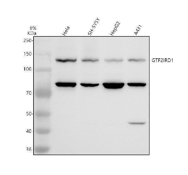 Anti-GTF2IRD1 Antibody Picoband® Boster Bio