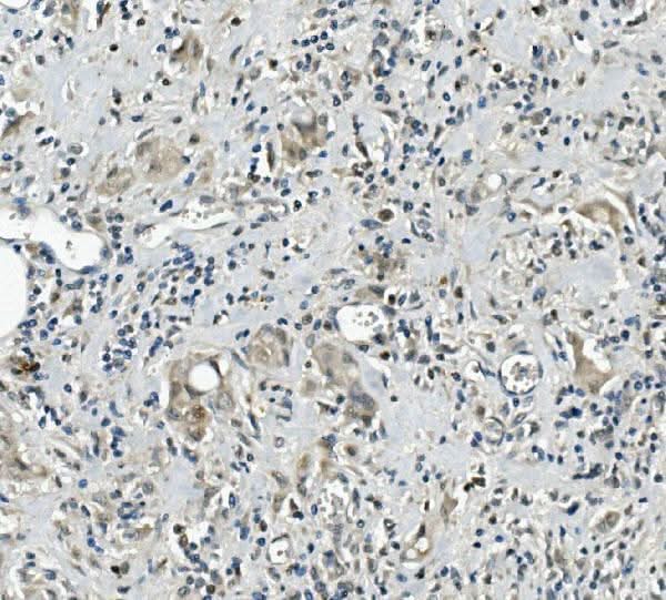 Anti-Calretinin/CALB2 Antibody Picoband® Boster Bio