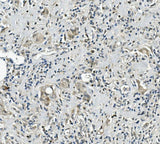 Anti-Calretinin/CALB2 Antibody Picoband® Boster Bio
