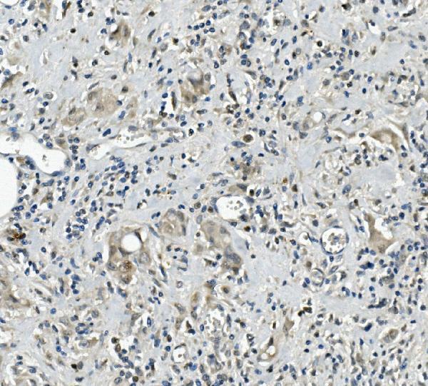 Anti-Calretinin/CALB2 Antibody Picoband® Boster Bio