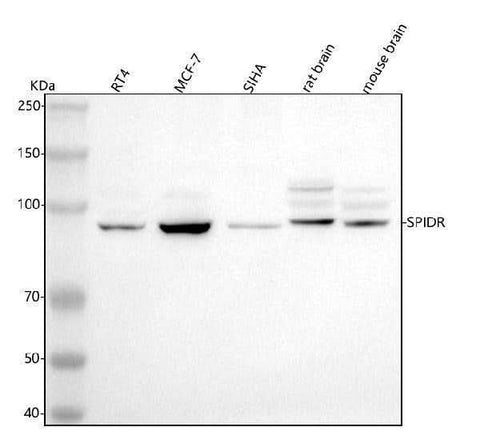 Anti-SPIDR Antibody Picoband® Boster Bio