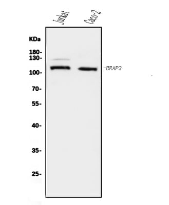 Anti-ERAP2 Antibody Picoband® Boster Bio