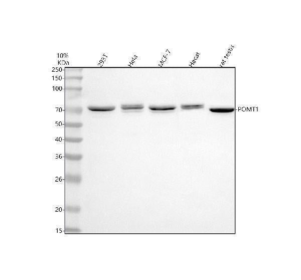 Anti-POMT1 Antibody Picoband® Boster Bio
