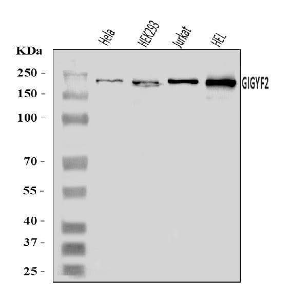 Anti-GIGYF2 Antibody Picoband® Boster Bio
