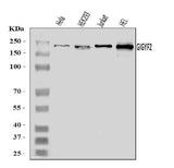 Anti-GIGYF2 Antibody Picoband® Boster Bio