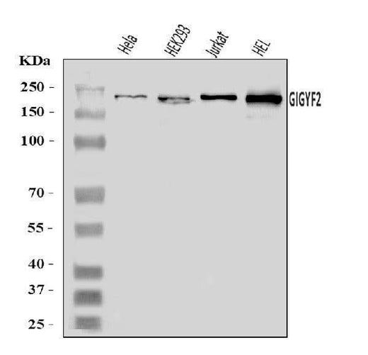 Anti-GIGYF2 Antibody Picoband® Boster Bio