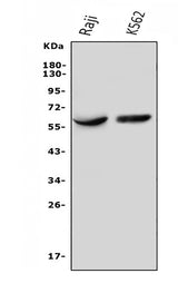 Anti-IL3RA/CD123 Antibody Picoband® Boster Bio