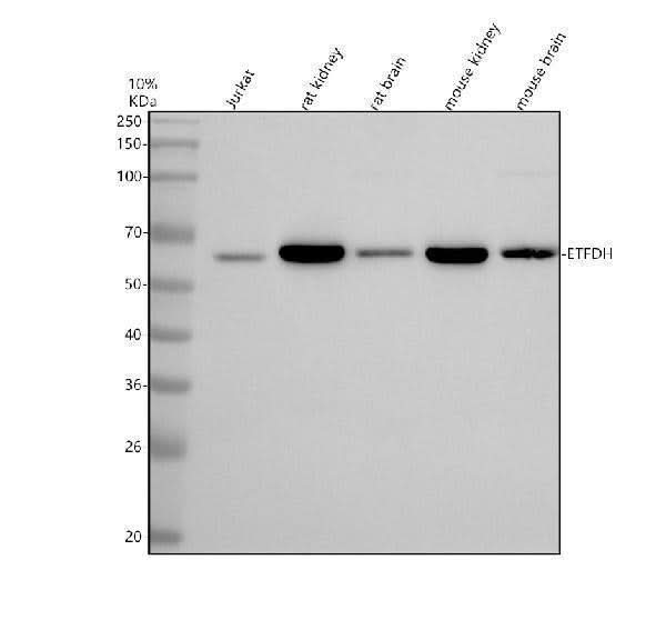 Anti-HEATR2/DNAAF5 Antibody Picoband® Boster Bio