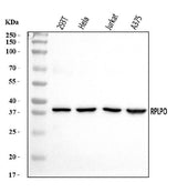 Anti-RPLP0 Antibody Picoband® Boster Bio