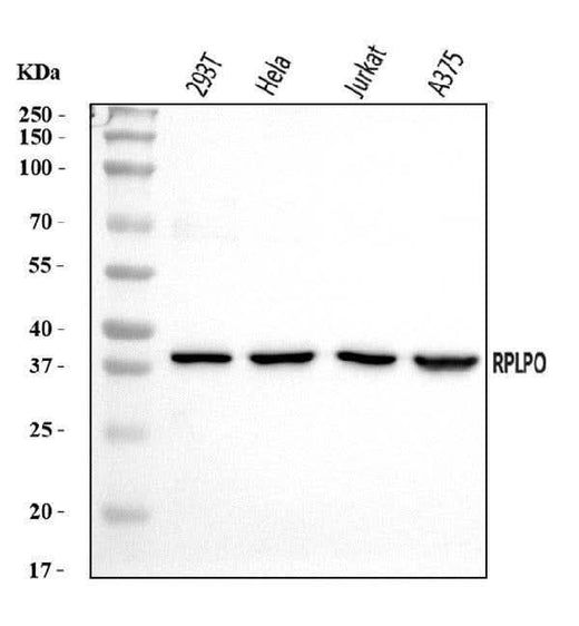 Anti-RPLP0 Antibody Picoband® Boster Bio