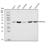 Anti-HMGCS2 Antibody Picoband® Boster Bio