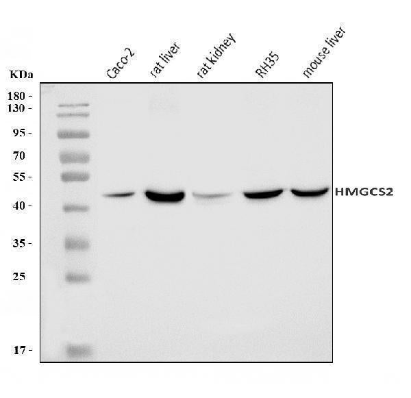 Anti-HMGCS2 Antibody Picoband® Boster Bio