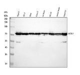 Anti-FACL4/ACSL4 Antibody Picoband® Boster Bio