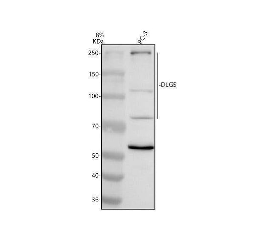 Anti-DLG5 Antibody Picoband® Boster Bio